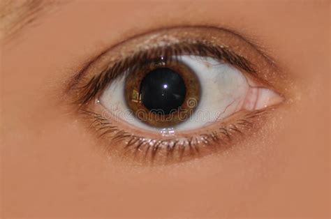 Dilated Pupils Vs Normal