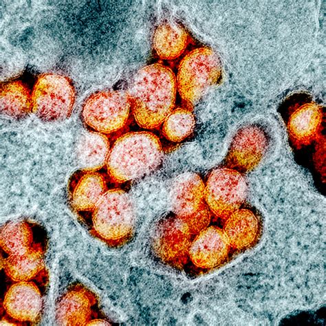 Electron Microscope Images Color Virus
