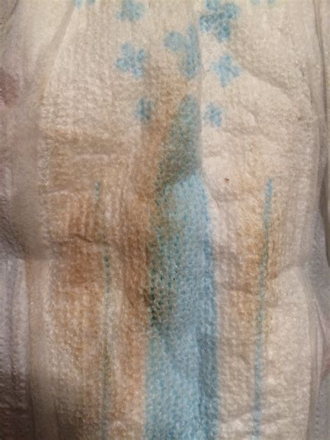 This is when the developing embryo plants itself in. TMI pic! 4 weeks + pregnant brown discharge | Netmums