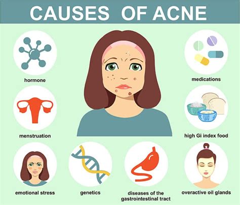 What Causes Cystic Acne And How To Treat It Effectively Sl Aesthetic