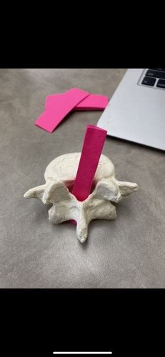 Lumbar Vertebrae Moose Flashcards Quizlet