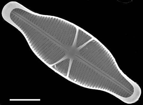 Image Gs02027303 Species Diatoms Of North America