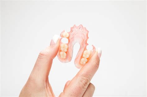 what are flexible partial dentures torrens dental care