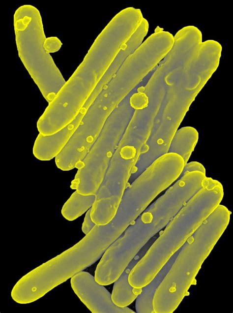 Mycobacterium Tuberculosis Microscopic Images Microscopic