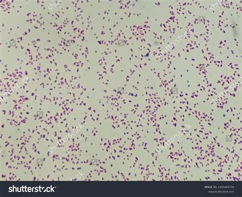 Gardnerella Vaginalis Genital Infection Bacterial Vaginosis Stock Photo