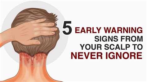 5 Early Warning Signs From Your Scalp To Never Ignore