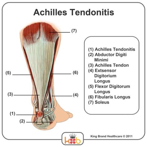 Achilles Tendon Anatomy Diagram Images And Photos Finder