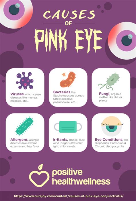 6 Causes Of Pink Eye Conjunctivitis Infographic
