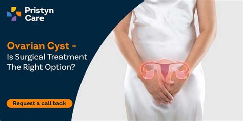 Ovarian Cyst Treatment Is Surgery The Right Option Pristyn Care