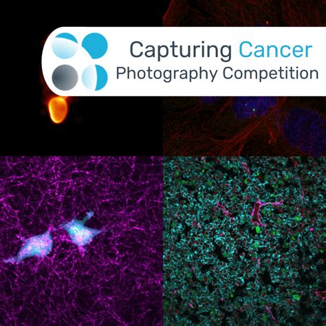 Capturing Cancer: Oncology Central Photography Competition winners ...