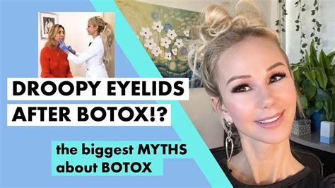 BAD BOTOX What Goes WRONG When You Get Botched Botox YouTube