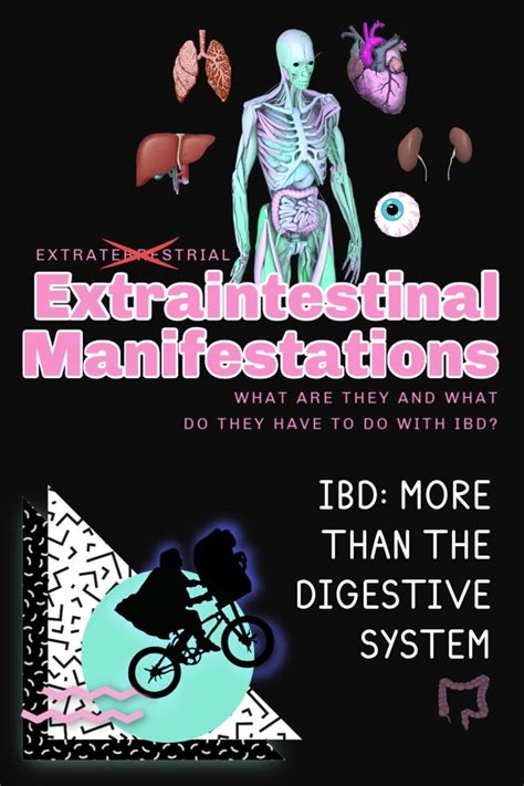 Pin On Extraintestinal Manifestations