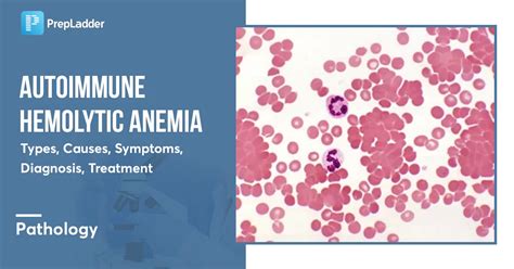 Autoimmune Hemolytic Anemia Types Causes Symptoms Diagnosis Treatment