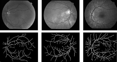 Figure 4 From Detection Of Anatomic Structures In Human Retinal Imagery Semantic Scholar
