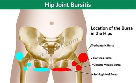 Effective Hip Flexor Stretch Hip Joint Bursitis Tendinitis Causes Signs Sy Bursitis