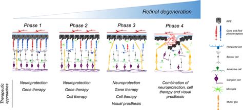 Progression Of Retinal Degeneration The Healthy Retina Consists Of Download Scientific Diagram