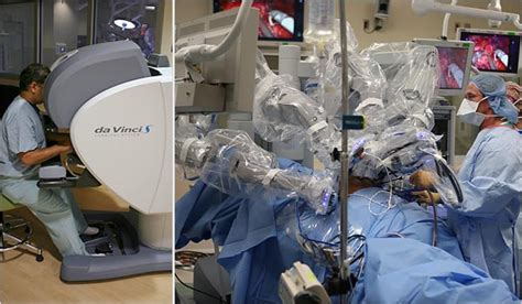 Results Unproven Robotic Surgery Wins Converts The New York Times