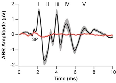 Abr Waveforms Grand Averages ± Sem Of Abr Waveforms In Response To