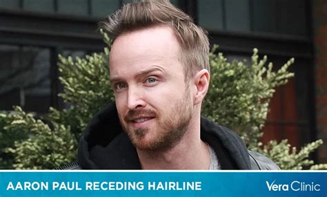 Aaron Paul Receding Hairline His Hairstyle Transformation