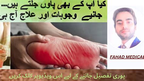 Paon Ki Jalan Ka Ilaj Urdu Hindi Feet Burning Kiun Hoti Hei Feet Sesation Ka Treatment