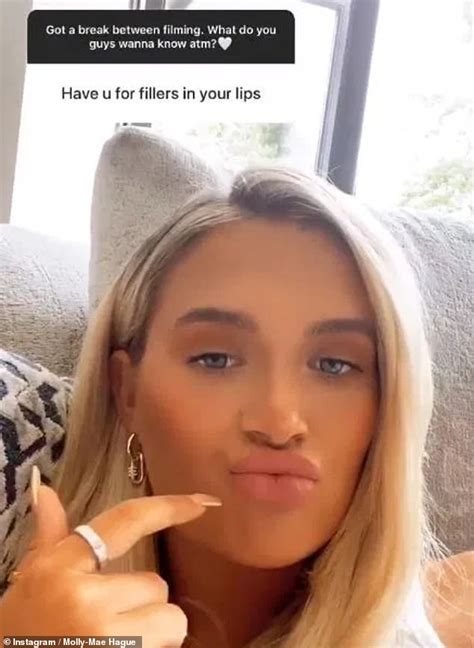 Molly Mae Hague Reveals She S Dissolved Her Lip Fillers Daily Mail Online