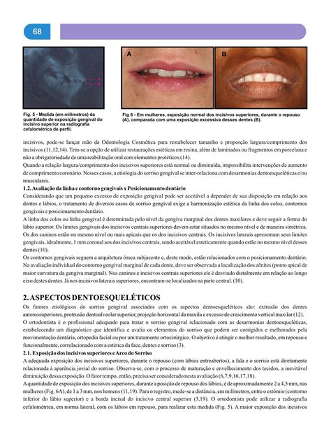 multidisciplinaridade na saúde bucal 6ª ed by rgo odonto issuu
