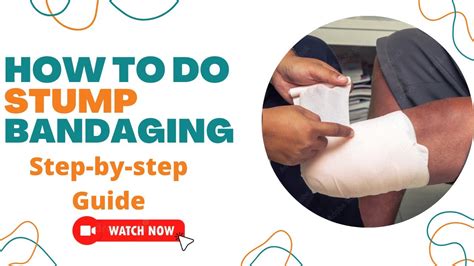 How To Do Stump Bandaging With Crepe Band For Above Knee Step By Step