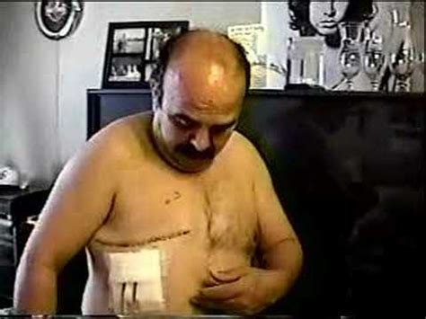 Because male breast cancer is relatively rare, it can be difficult finding the information you need. Men, we do get Breast Cancer! - YouTube