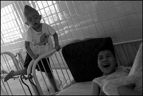 Alfred Yaghobzadeh Photography Vietnam Agent Orange Babies
