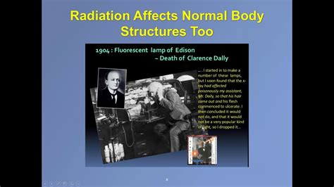 Know the types, grades, causes, signs, symptoms, treatment of brain tumor. WEBINAR: Radiation Therapy for Brain Tumors - YouTube