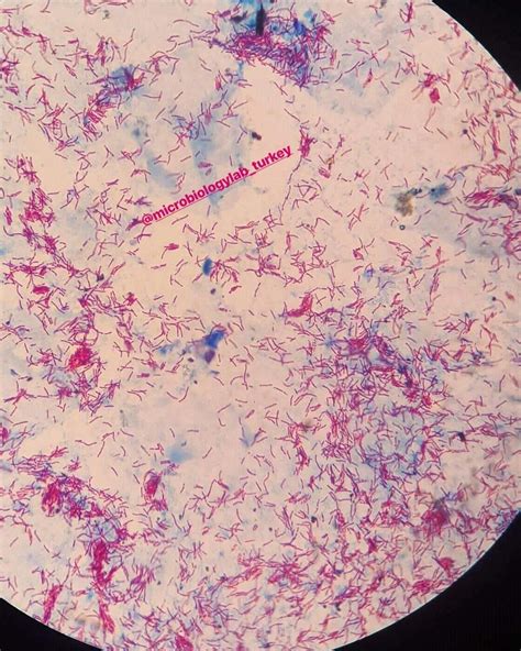 Mycobacterium Tuberculosis Afb 🔬😍💜mikrobiyoloji Microbiology