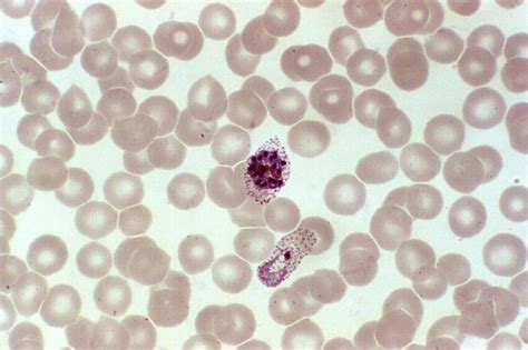 Gratis Billede Photomicrograph Shows Rødt Blod Celle Infektion