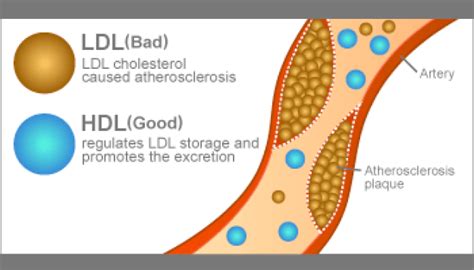 What Is Non Hdl Cholesterol 99science