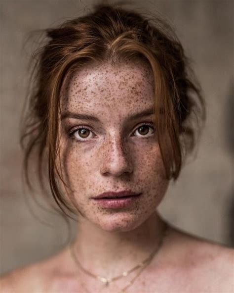 A Woman With Freckles On Her Face And Chest
