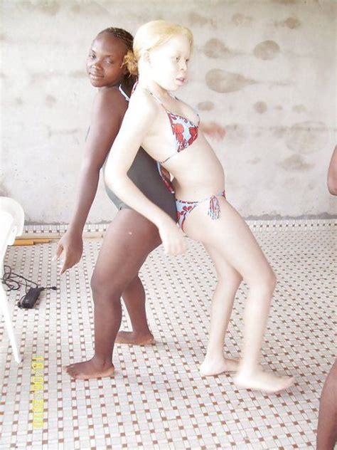 Albino Girl Nude Mckayla Maroney Nude