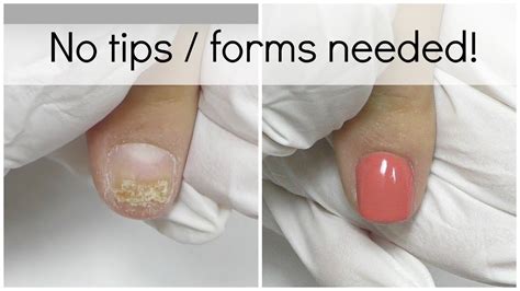 How To Fix Nails Damaged By Acrylics Nail Ftempo