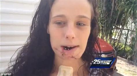 Florida Pizza Delivery Woman Shot In Face By Halloween Mugger Leaves Hospital Daily Mail Online
