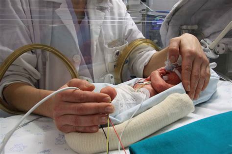 Día Mundial Del Neonato Más Del 70 De Los Bebés Prematuros Consigue