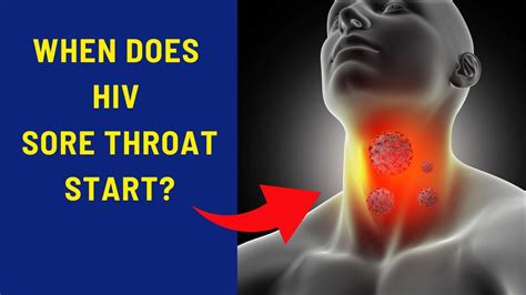 When Does Hiv Sore Throat Start Youtube