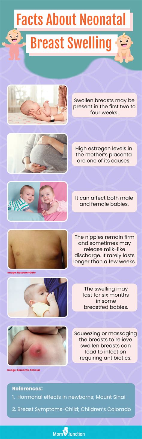 Unexpected Causes Of Swollen Breasts In Newborns