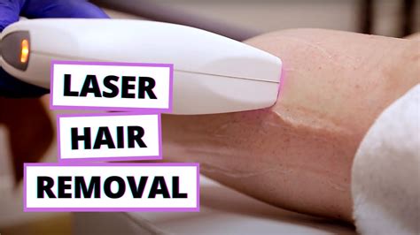 Laser Hair Removal The Process BEFORE AFTER YouTube