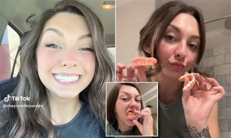 Toothless Babe Reveals How She Was Forced To Get Dentures At The Age Of Just 20 To Replace Her