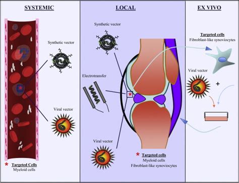 Prospects For Gene Therapy In Inflammatory Arthritis Musculoskeletal Key