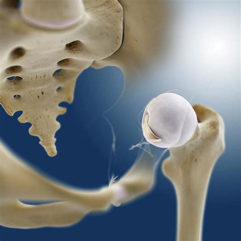 Hip Anatomy Photograph By Springer Medizin Science Photo Library Hot Sex Picture
