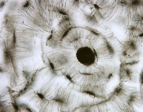 Human Bone Cells Under Microscope
