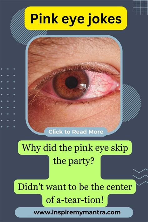 200 Pink Eye Jokes Giggles Amidst The Redness