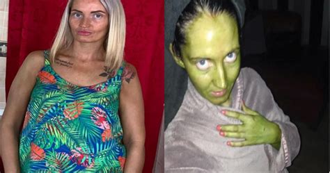 Woman Turns Green After Using Expired Fake Tan Cream Olomoinfo
