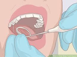 Your body can strengthen weak enamel itself if you eat fortifying to keep your tooth enamel strong, the american dental association recommends brushing your teeth talk to your doctor about treating your condition and finding viable remedies. Treat Weak Tooth Enamel