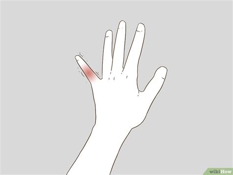 Sometimes, the nail can be damaged. Comment savoir si un doigt est cassé: 18 étapes