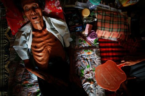 Hiv merupakan virus yang boleh menyebabkan imuniti badan menurun. 5 Virus Yang Paling Berbahaya Di Dunia | Iluminasi